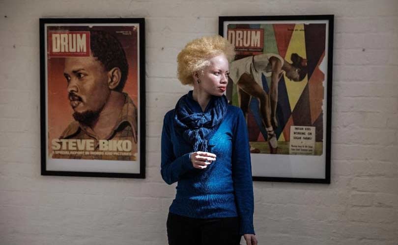 Thando Hopa, la lucha de la modelo albina suráfricana Thando Hopa, la lucha de la modelo albina suráfricana